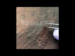 You Can Feel This Extraction Through the Screen | Ingrown Hair Removal Ep. 3