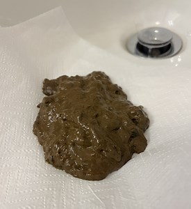 LITTLE STINKY and FLUFFY POOP