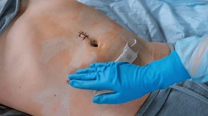 Mains de secouristes ou d'infirmières dans : vidéo de stock (100 % libre de droit) 3521773015 | Shutterstock