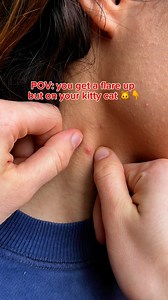 Struggling with painful boils in your vaginal area? 🥴 This Universal Flare Care draws out pus and inflammation from underneath the skin and works to restore your skin back to health. #SkinHealer #naturalproducts #dailyskincare #skinlove #skincaretips #naturalskincare #lifechangingskincare #mymagichealer #staphinfection #abscess #skininfection #infection #cyst #infectedskin #skinproblems #infectedcyst #skininflamation | Mymagichealer