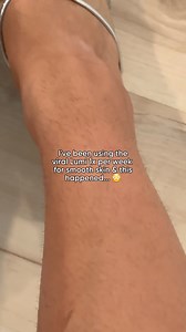 Say goodbye to prickly legs and hello to permanently smooth skin! 👇 👋 Exfoliate with our exfoliating glove to gently rub away dead skin and prep your legs for Lumi ✨ Plug Lumi in, select your desired intensity, and glide it over areas with unwanted hair 💧 Moisturize with Aloe Coco Body Lotion for beautiful hydrated legs! In only 6-12 uses, you can have the forever smooth skin of your dreams 😍 Where would you use Lumi first? | Rose Skin Co