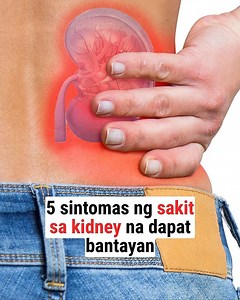 297K views · 4.4K reactions | Huwag Balewalain ang mga Sintomas ng Kidney 梁 #Kidney #signs #symptoms #everyone | Better Being | Facebook