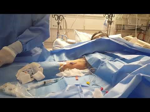 PICC Line Insertion