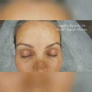 Eyebrow Feathering transformation by Sarah Moran at Sarah's Beauty Ink P. 9773 5069 | M. 0422 752 440 #sarahsbeautyink #beauty #feathering #featherstroke #eyebrowfeathering #cosmetictattoo #spmu #permanent #makeup #microblading #micropigmentation #microstroke #browsonfleek #browsbysarah #browtattoo #eyebrowspecialist #eyebrowfeatheringsydney #browtattoo #embroidery #feathertouchbrows #featherbrows #sydney #bankstown #Milperra #beautyblogger #eyebrowfeatheringvideo | Sarah's Beauty Ink