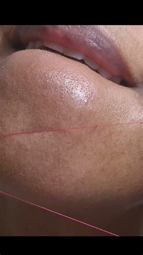 frustrating #satisfying #hairremoval #beautycare #threading #hairy #pcos #beauty #skincareroutine