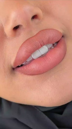 Nouveau sourire, nouvelle vibe! Aujourd’hui جبتلكم résultat تاع تجميل الأسنان… صراحة c’est incroyable كيفاش détail صغير يبدّل الكونفيدانس كامل! Si vous pensez تهتمّو بابتسامتكم، نقولكم: foncez! Parce qu'un beau sourire يبدّل كلشي! ✨ #Sourire #Dentisterie #DentalCare #SmileDesign #Algerie #Canada #Montreal #Alger #Beauté | Islãm Bēn | Facebook