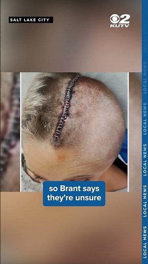 11-year-old hit by car in Roy relearning how to walk, talk