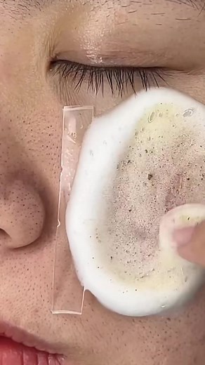 #decompression #facialcleanser #funnyvideos #facial #blackhead #foryou #fypシ