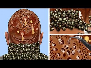 ASMR Removal Dog Ticks in the Neck & Maggot Infested Head | Deep Cleaning Animation
