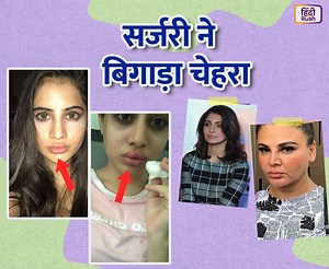 308K views · 300 reactions | Plastic surgery gone wrong! शक्ल ठीक...