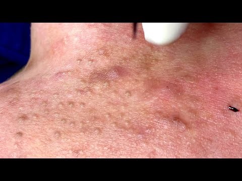 Relax Every Day With Sac Dep Spa #0215