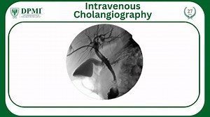 Intravenous Cholangiography: कोलेजनियोग्राफी का लक्ष्य क्या है? How is Intravenous Cholangiography done? What are the advantages of cholangiography? Intravenous Cholangiogram (IVC): Bile Duct Procedure and Indications. JOIN DPMI TODAY AND LET YOUR CAREER TAKE A NEW SHAPE..!! ADMISSION FOR ACADEMIC SESSION 2024-25 IS OPEN FOR MORE DETAILS Visit: https://dpmiindia.com/ #Cholangiography #IntravenousCholangiogram #IVC #IntravenousCholangiography #BileDuctProcedure #MedicalLabTechnician #DMLT #Bachel