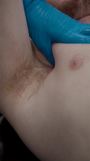 Alivio del Dolor en la Parte Media de la Espalda