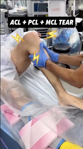 Physical exam: Knee with torn ACL + PCL + MCL #Anatomy #MedicalStudent #usmle #Medical #Education