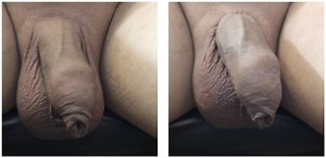 10 minute time lapse cock banding with elastrator band