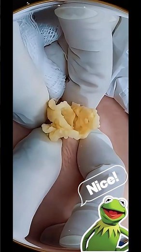 Incredible Cyst Popping That Will Shock You!