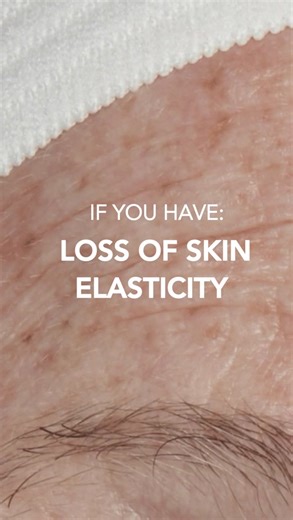 If you have this, use that! #ifyouhavethisusethat #dermatologistrecommended #skincare #beforeandafter