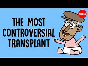 One surgeon's obsession with head transplants - Max G. Levy