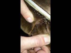 Bedbug inspection HD