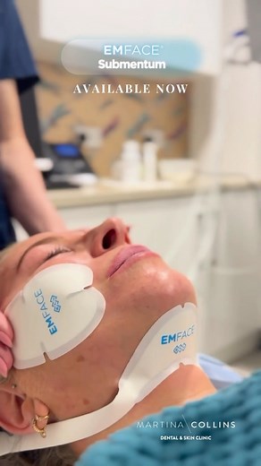 Emface Submentum is now available to book at our clinic! The best way to reduce your double chin, let me tell you why… 🥰 Emface uses two technologies that work to lift and tone the skin and facial muscles. Emface submentum is a newly launched addition to the wonderful Emface treatment. You can treat the submentum area on its own or with the cheeks, the choice is yours. Emface submentum will target the fat cells while toning the skin in the area so you aren’t left with any excess tissue. 🙌🏻🙌�