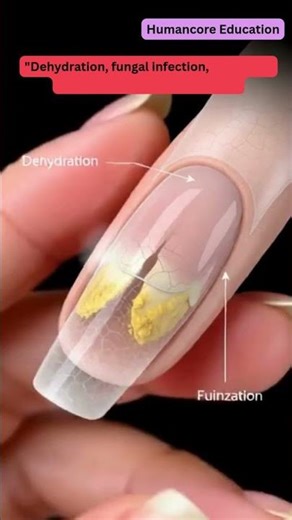 This Nail Condition Is More Dangerous Than You Think