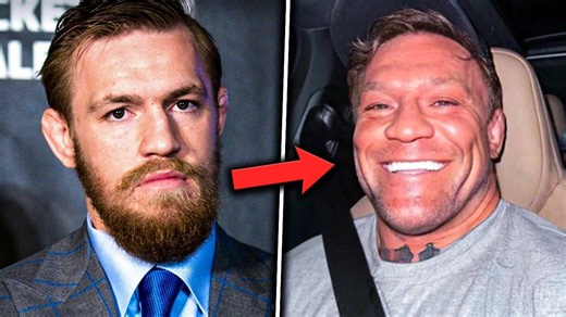 Conor McGregor ma Teraz NOWĄ TWARZ!