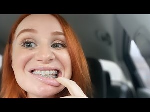 Getting braces as an adult! Clear braces