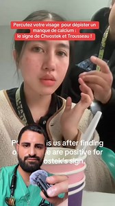 242K views · 3.2K reactions | De nombreuses causes existent, donc si vous présentez ce signe consultez votre médecin ! ##sante##medical##test##prevention##chvostek##calcium##vitamin##vitamines##vulgarisation##incroyable. | Doctor.Anesthesia | Facebook