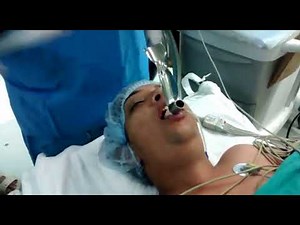 Endotracheal intubation with Fastrach LMA