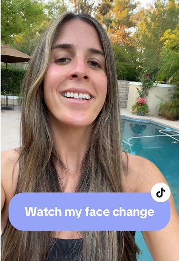 Transform Your Smile: Palate Expander Journey