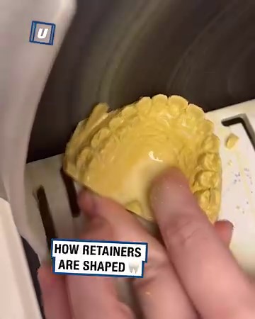 439K views · 540 reactions | This is how teeth retainers are made! 醴 | UNILAD Tech | Facebook