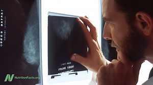 Odds are most women will get at least one false-positive mammogram, but thankfully most women who are recalled back for further testing of a suspicious mammogram finding do not end up having cancer after all. The video sources, transcript, and doctor's notes are available here: http://bit.ly/2ALV8Xj | NutritionFacts.org