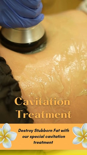 Cavitation treatment utilizes ultrasound waves to burst localized fat cells, offering a non-surgical method for body contouring and cellulite reduction. Beyond aesthetics, this same principle is medically applied to break apart kidney stones, dissolve blood clots, and deliver targeted drug therapies. #CavitationTreatment #UltrasonicCavitation #BodyContouring #FatReduction #NonSurgical #MedicalTechnology #HealthTech #Aesthetics #Wellness | VIVO Clinic UAE