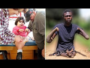 15 Rarest And Unique People You Won't Believe!