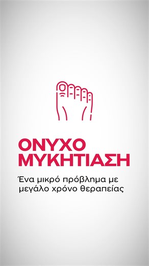 Αντιμετωπίζετε προβλήματα με μύκητες στα νύχια; Η ονυχομυκητίαση μπορεί να φαίνεται μικρό πρόβλημα, αλλά απαιτεί μακροχρόνια θεραπεία. Στο Metropolitan Hospital προσφέρουμε εξειδικευμένες θεραπείες που στοχεύουν στην αντιμετώπιση αυτής της δυσάρεστης κατάστασης. Εμπιστευτείτε τους ειδικούς μας και ανακτήστε την υγεία των νυχιών σας! 👉 https://bit.ly/3zNwzeZ #Onychomycosis #NailFungus #NailHealth #MetropolitanHospital #HealthyNails #NailCare #SummerTips | Metropolitan Hospital