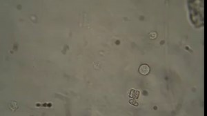 Trichomonas | Medical Laboratory Scientists