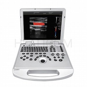 [Hot Item] Manufacturer Ultrasonido Portable Color Doppler Ultrasound Machine