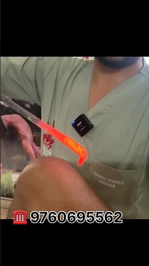 🩺 Avascular Necrosis (AVN) – A Reversal Journey with Ayurveda 🩺