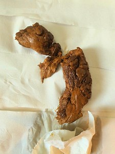 Pooping on toilet lid.