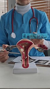 Model Female Reproductive System Uterus Birth Stock Footage Video (100% Royalty-free) 3703204125 | Shutterstock