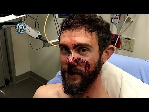 Colorado Man, Travis Kauffman, Survives Mountain Lion Attack