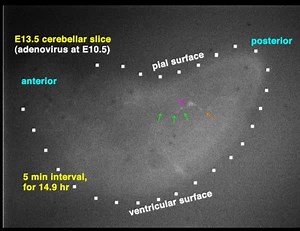 File:Migration-early-axonogenesis-and-Reelin-dependent-layer-forming-behavior-of-earlyposterior-born-1749-8104-5-23-S6.ogv - Wikimedia Commons