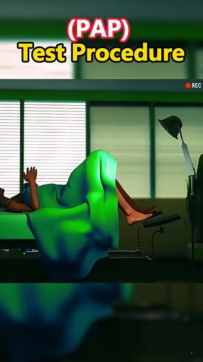 18K views · 34 reactions | PAP Test Procedure 3d animation!!! #pap #paptest #smear #animation #papsmear #hpv #hpvawareness #medical #education | Amazing Story | Facebook