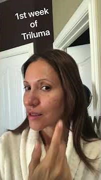 Healing my Melasma and sun damage with Tri-luma