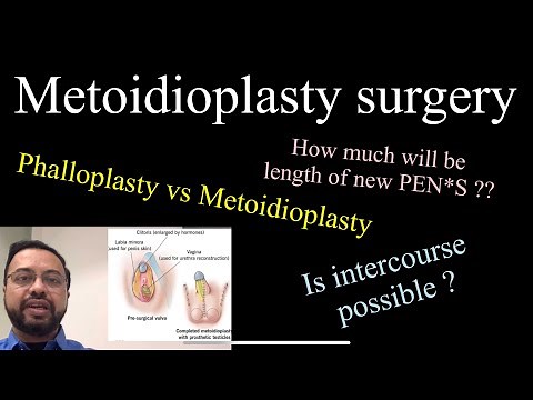 Metoidioplasty vs Phalloplasty . female to male transgender bottom surgery . Penis creation surgery