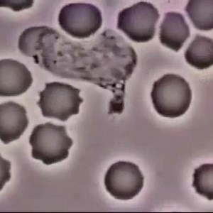 White blood cell chasing and catching bacteria | Dr. Ryan Cedermark