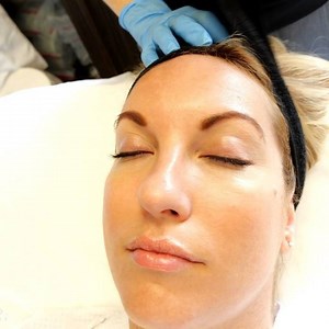 13 reactions | Dermalfusion is one of our favorite treatments at the spa. It extracts, exfoliates and hydrates the skin. It’s the perfect treatment for that holiday glow. Holiday price $199, regular $299. Call 310 777 8880 to book your appointment. | Dr. Kami Parsa | Facebook