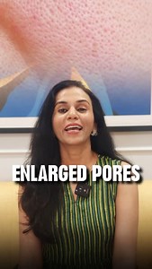 15K views · 355 reactions | Shrink Enlarged pores Naturally with...