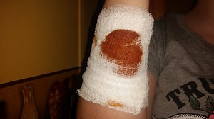 The Survival Medicine You’ve Probably Never Heard Of