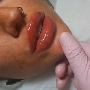 Gorgeous Russian Lips created on todays masterclass with our student. . Beautiful shape. ❤老 #RUSSIANLIPKING | Flawless Beauty Clinic | Facebook